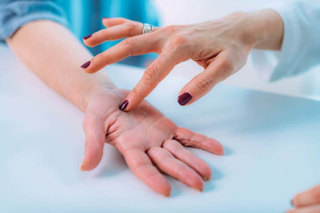Síndrome del túnel carpiano: una doctora señala la zona de la mano dolorida